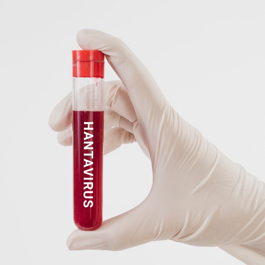 faqsquare faq hanta virus 600