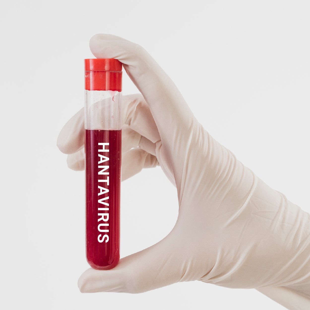 faqsquare faq hanta virus 600